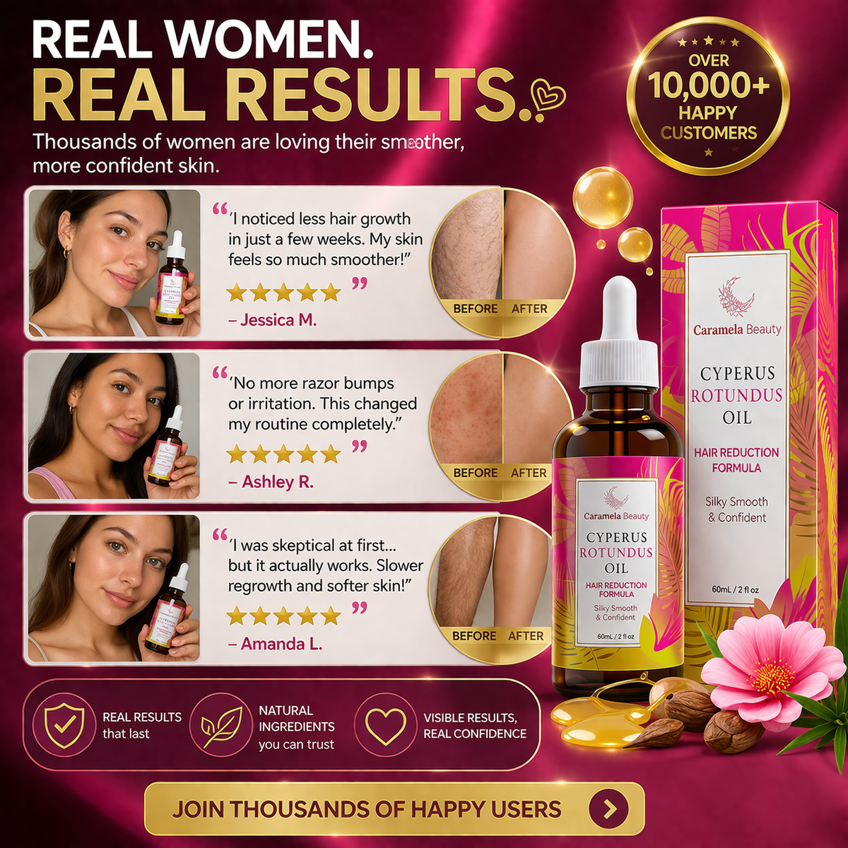 Aceite de Cíperus Rotundus de Caramela Beauty para reducir el vello facial y corporal naturalmente, en botella de 100 ml.
